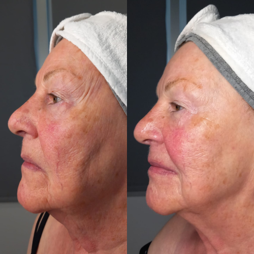 Trattamento viso anti-age Age Factor