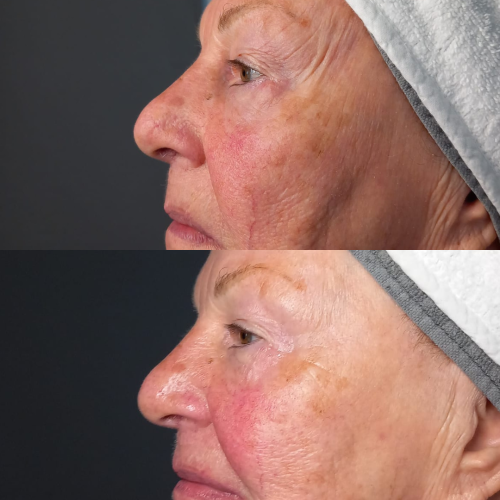Trattamento viso anti-age Age Factor
