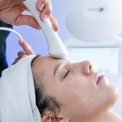Trattamento viso mySKINETIC